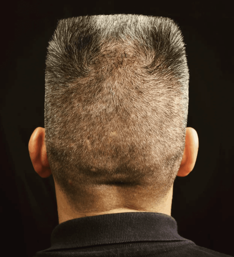 Afeitado de Cabeza